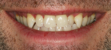 Before dental procedure photo
