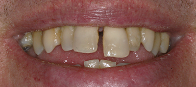 Before dental procedure photo