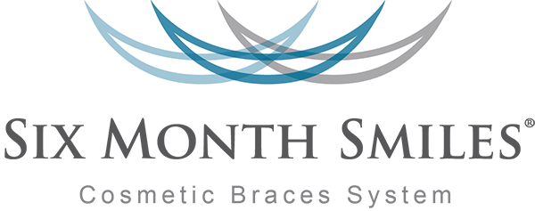 Easy Clear Adult Braces - Six Month Smiles 