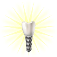 dental implant