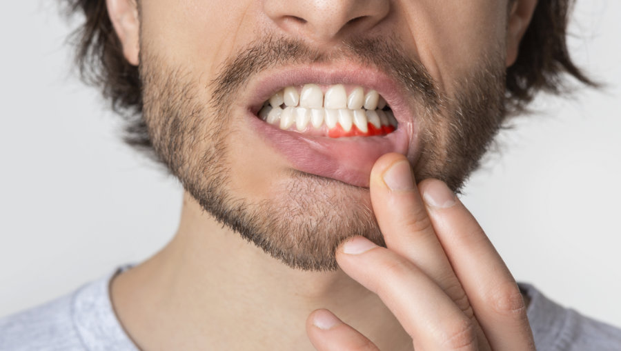 man with tooth infection
