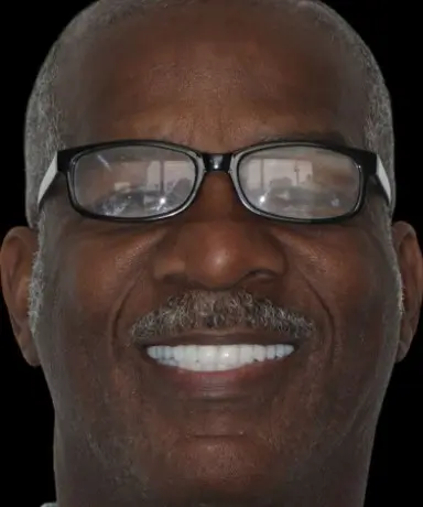 A man with short gray hair and mustache smiles, showing his teeth, and wears eyeglasses with reflections on the lenses against a black background.