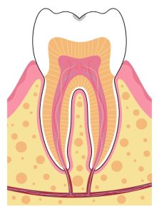 Cross-section diagram of a tooth showing enamel, dentin, pulp, nerves, gums, and surrounding jawbone.
