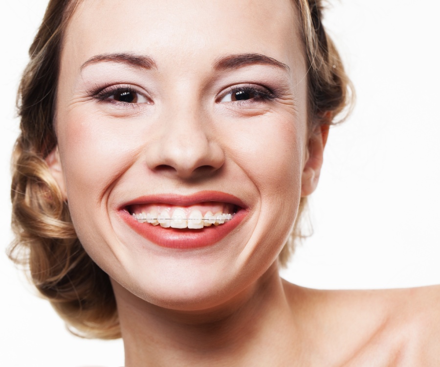 A person with light skin and wavy hair smiling, showing teeth with clear braces, against a white background.
