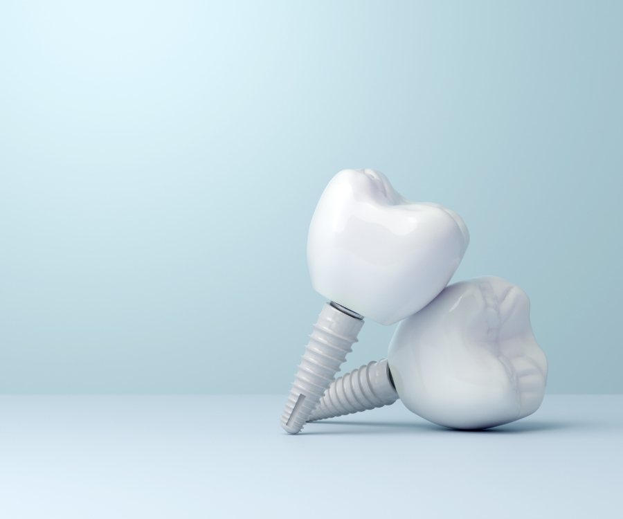 Two dental implants with realistic tooth crowns and metal screws are placed on a light blue surface against a light blue background.