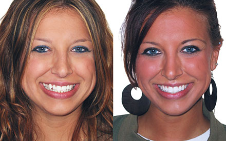 Two women with similar facial features smiling at the camera; one has lighter hair and smaller earrings, the other has darker hair, large circular earrings, and a slightly tanner complexion.