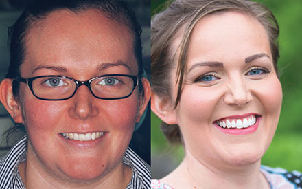 Side-by-side comparison of a woman before and after a transformation; first image shows her with glasses, second shows her without glasses, smiling with makeup.